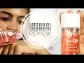 Bio Oil Review - Does Bio Oil Work on Stretch Marks Scars SuperWowStyle