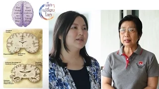 การป้องกันสมองเสื่อมควรทำอย่างไรในชีวิตประจำวัน