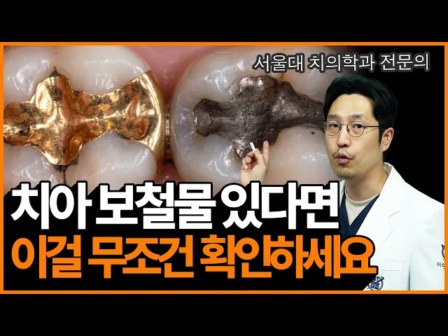 치아 보철물 [크라운 / 인레이] 언제 교체를 해야할까?