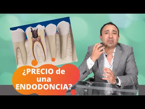 Download MP3 ¿Cómo se cobra una ENDODONCIA en México? 2021 | Dr. Alvaro Campos