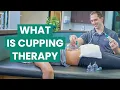 What is Cupping Therapy Types Benefits and Treatment Foothills Sports Medicine Physical Therapy