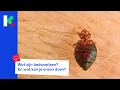 Yikes bed bugs at camp Now what