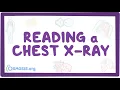 Download Lagu Reading a chest X-ray