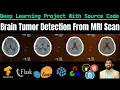 Brain Tumor Detection Using Machine Learning Deep Learning Project With Code