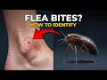 How to Identify Flea Bites on Humans Pets Warning Signs You Shouldn t Ignore