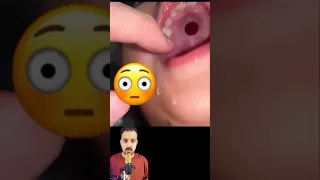 تعرف ايه ده   دندنها