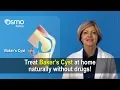 Baker s Cyst Treatment - What you need to know