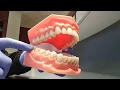 Tooth Numbering System