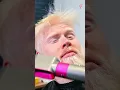 Albino Transformation Love at First Sight