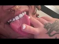 @Liljitm3n - MOPS OUT- (official Audio)