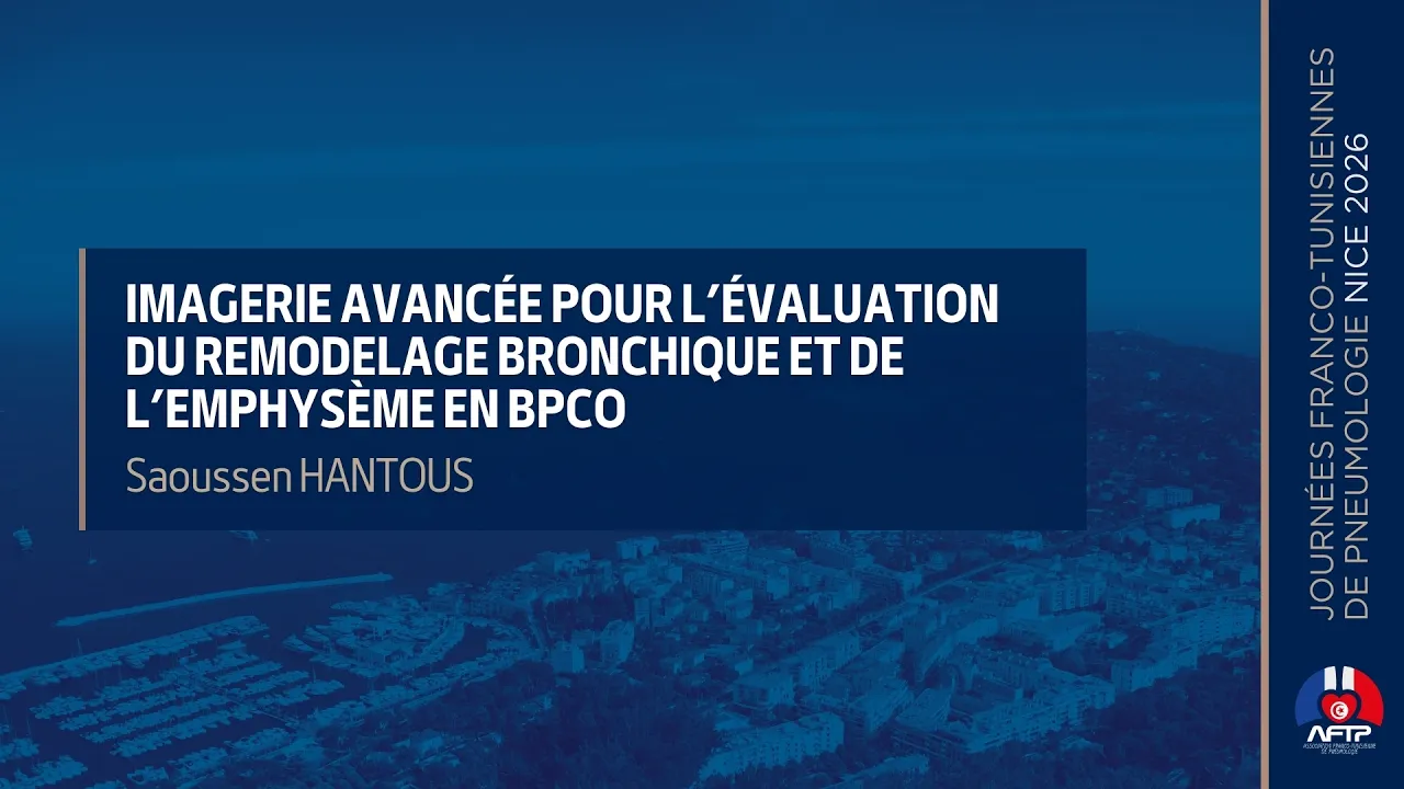 Imagerie avancée & IA dans l’évaluation de la BPCO et de l’emphysème. Saoussen Hantous