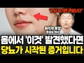 Download Lagu '이런 게' 몸에서 느껴지면 당뇨가 시작된 신호입니다 (최석재 원장 / 3부)