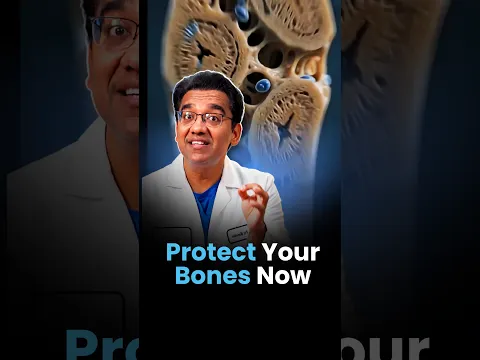 The Shocking Truth About Women’s Bone Health