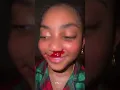 Lani Love Got a Nose Bleed