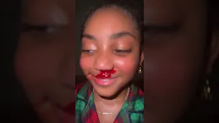 Lani Love Got A Nose Bleed Shorts Lanilove Nosebleed 