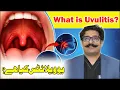 Uvulitis Explained Swollen Uvula Causes Symptoms Treatment ENT Specialist