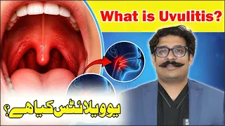 Uvulitis Explained Swollen Uvula Causes Symptoms Treatment ENT Specialist