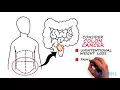 Abdominal and Pelvic Masses What location can tell you about a mass
