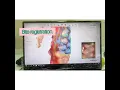 Download Lagu Intra Oral Scanning for Invisible Braces at Peach Dental Clinic.