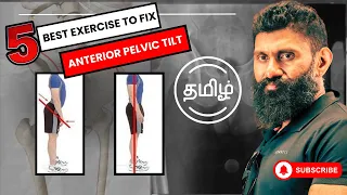 anterior pelvic tilt 5 exercises to fix postural correction biglee tamil