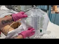 Nursing Skills Applying The Male External Urinary Catheter Condom Catheter