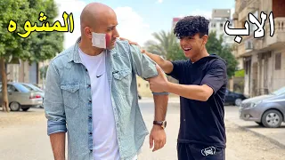 ولد يستعر من ابوه لانه مشوه فماذا فعل الاب 