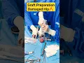 Download Lagu 🔥गले हुए कूल्हे की हड्डी से ग्राफ्ट बनाना | Graft Preparation from AVN Hip #avascularnecrosisofhip