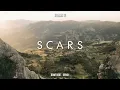 Download Lagu JEDAG JEDUG !!! Rawi Beat - Scars - ( New Remix )