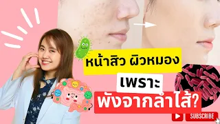 จุลินทรีย์ในลำไส้ไม่สมดุลส่งผลต่อผิวหนังอย่างไร