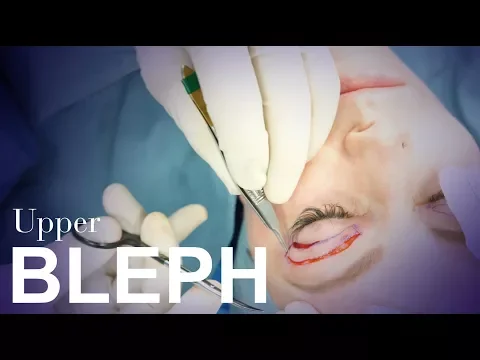 Upper Eyelid Blepharoplasty