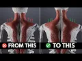 How To actually Fix Tight Upper Traps