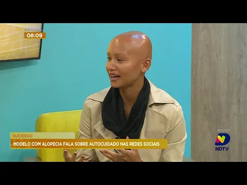 Modelo faz sucesso nas redes sociais com dicas sobre queda de cabelos e calvície