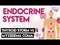 Thyroid Storm vs Myxedema Coma Endocrine System Part 6