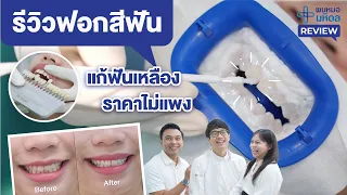 ผลของการฟอกสีฟันจะคงอยู่นานแค่ไหน