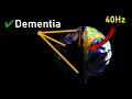 Download Lagu IT'S HERE ❯❯❯ The Dementia \