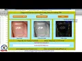 Fingernail Disease Detection Using Deep Learning CNN Matlab Project With Source Code