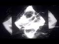 Download Lagu UdieNnx - AKAI (Super Slowed + Reverb)