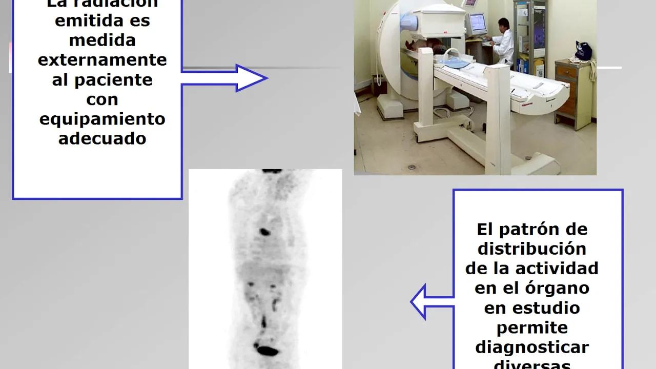 Radiofarmacia - Radiofármacos de diagnóstico