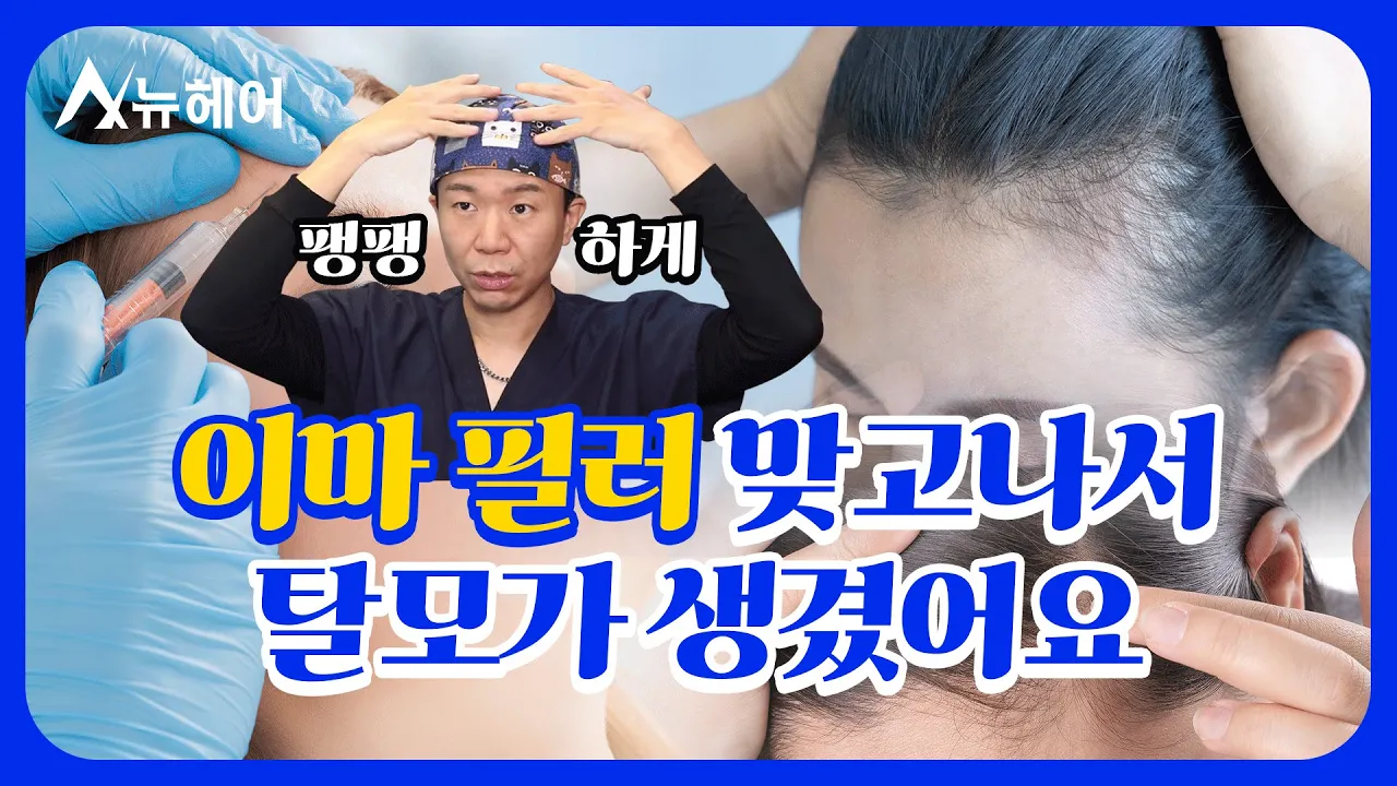 이마 필러 부작용이 탈모??|뉴헤어