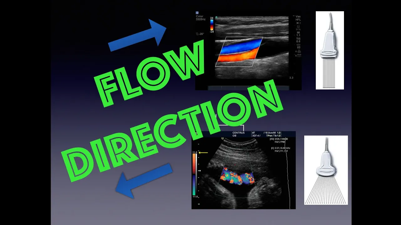 How to Determine Blood Flow Direction with Ultrasound and Doppler