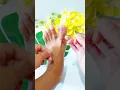 Download Lagu Aneh tapi ajaib 😱 hanya 1 karet gelang 😱⁉️#tips #tipsehat #infosehatalami #karetgelang