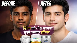 Skin को गोरा करने वाली 🔥 Best  Fairness Creams in 2026