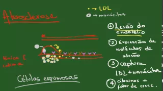 Degenerações Parte 1 (Acúmulos Intracelulares) - Resumo - Patologia