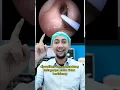 Cara dokter tht membersihkan kotoran telinga #dokter #telinga