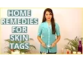 3 Best Natural Home Remedies To REMOVE SKIN TAGS At Home - DIY