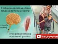 Download Lagu Poliomielite (Paralisia Infantil)