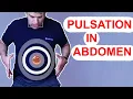 Pulsation in the Stomach Abdomen - Aortic Aneurysm USMLE 1