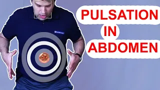 Pulsation in the Stomach Abdomen - Aortic Aneurysm USMLE 1