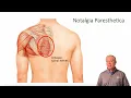 Download Lagu Notalgia Paresthetica | ChiroUp