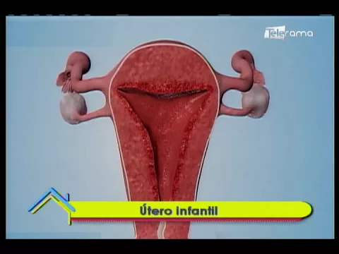 Útero infantil
